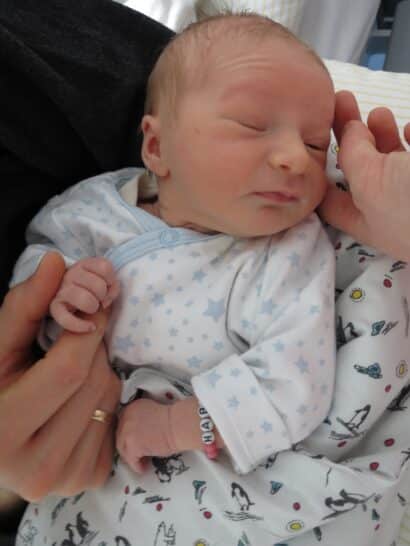 Pregnancy, Birth, and Neonatal Period With a Child With PCH2