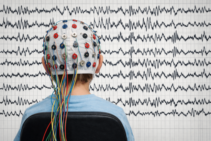 Online Sprechstunde: „Meet The Expert“ Zu Epilepsie Bei Pch2 + Download